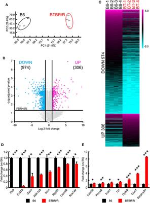 Comprehensive Profiling of Gene Expression in the Cerebral Cortex and Striatum of BTBRTF/ArtRbrc Mice Compared to C57BL/6J Mice